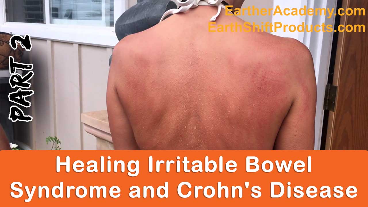 Healing Irritable Bowel Syndrome and Crohn's Disease Part 2