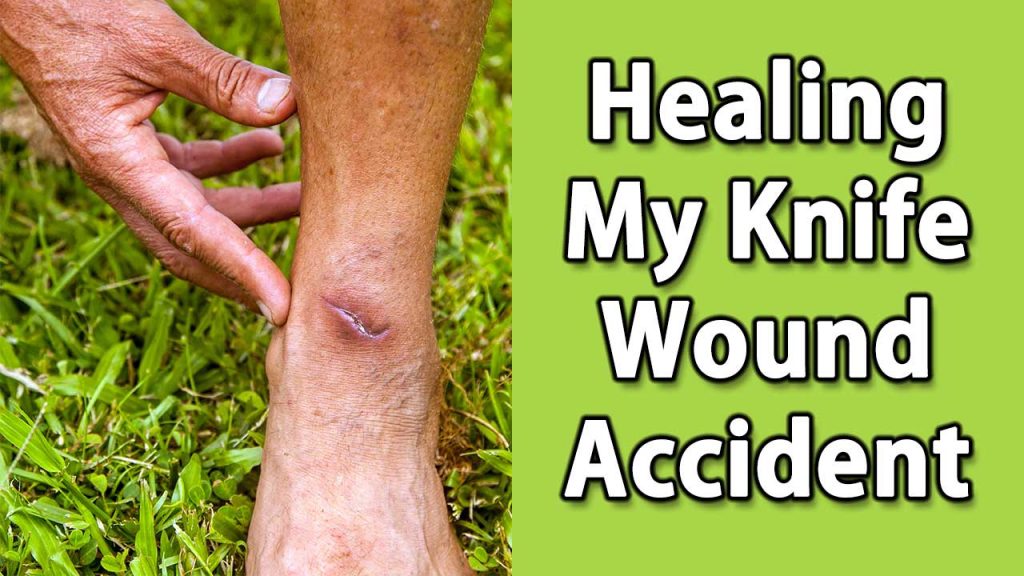 Healing My Knife Wound Accident Earther Academy