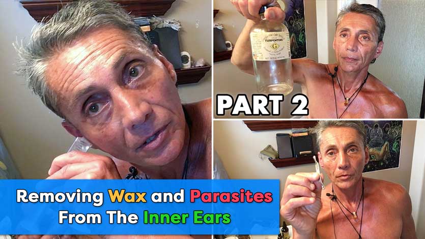 Removing Wax and Parasites From The Inner Ears Part 2