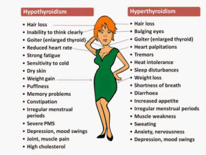 Hypothyroidism Issues