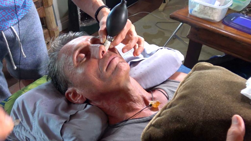 Dr. Robert Cassar getting a Cranial Facial Release (CFR)