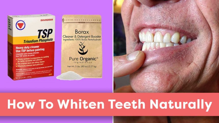 How To Whiten Teeth Naturally