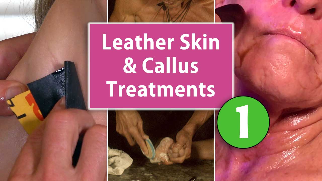 Leather Skin and Callus Treatments Part 1