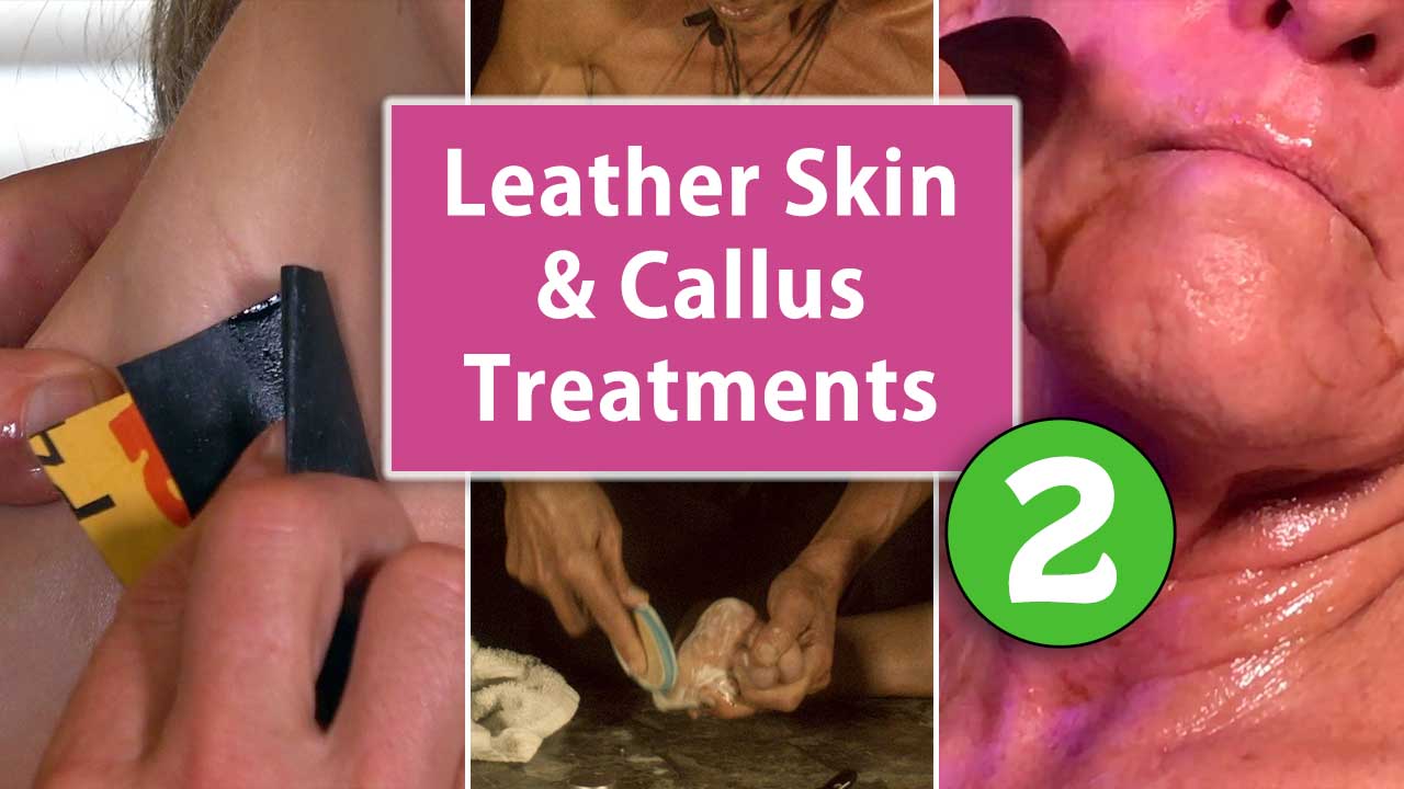 Leather Skin and Callus Treatments Part 2