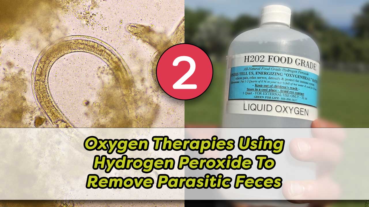 Oxygen Therapies Using Hydrogen Peroxide To Remove Parasitic Feces Part 2