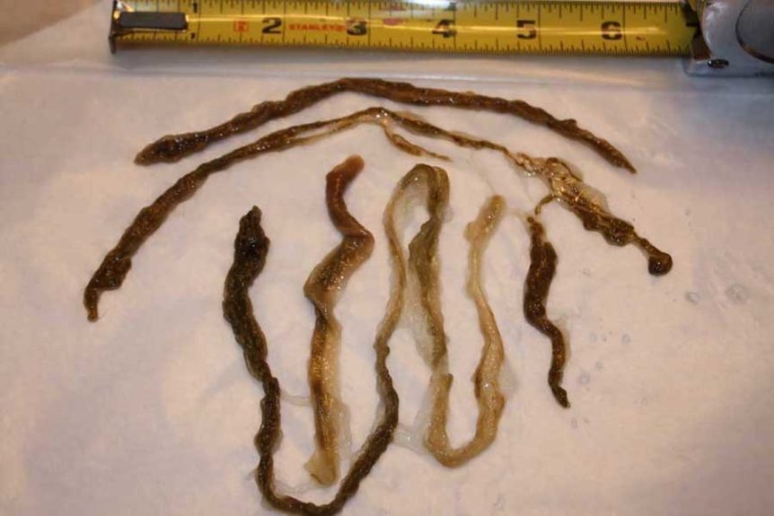 Enemas For Parasite And Toxicity Removal Earther Academy