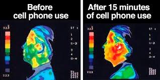 Thermography Of The Skull Before And after Cell Phone Use