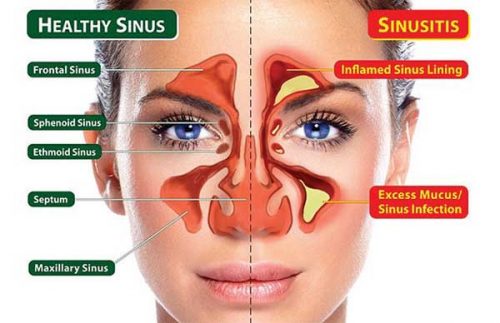 using-the-nasal-neti-pot-for-cleansing-the-sinus-cavities-earther-academy
